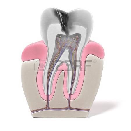Endodonzia a Roma